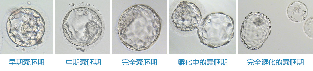 囊胚期胚胎培养-安安试管婴儿中心,不孕症,试管婴儿,人工受孕,冷冻卵子