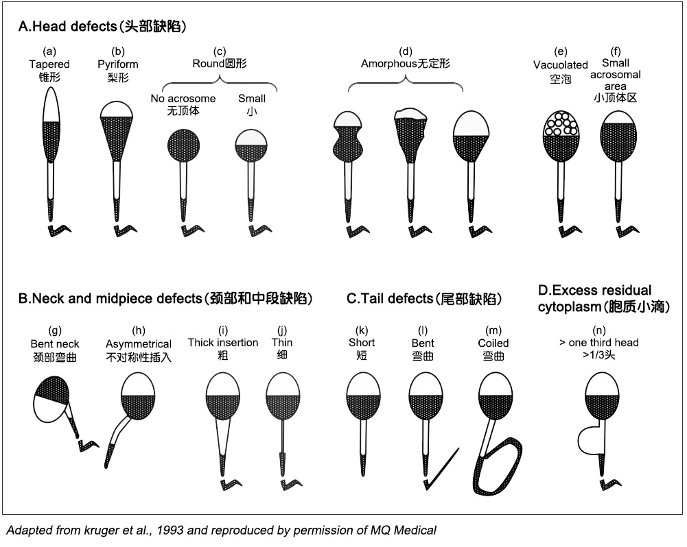 精子型态