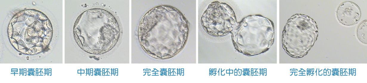  囊胚期胚胎培養-安安試管嬰兒中心,不孕症,試管嬰兒,人工受孕,冷凍卵子