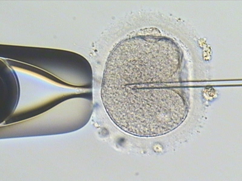 Intracytoplasmic sperm injection (ICSI)