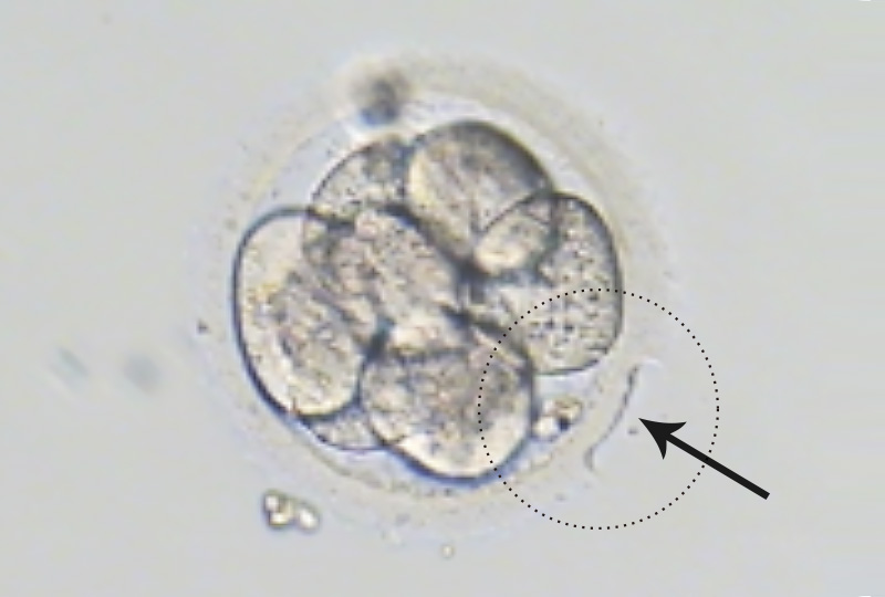 Laser-Assisted hatching </br>(L-AH)