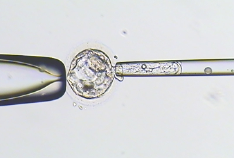 Pre-implantation genetic testing for aneuploidy </br>(PGT-A)